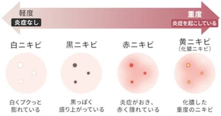 ニキビに絆創膏はあり？知恵袋で多い疑問を皮膚トラブル目線で整理